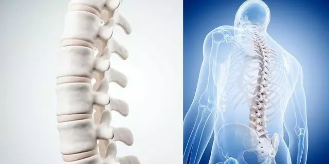 Desh Sahni, MD- Capital Brain and Spine