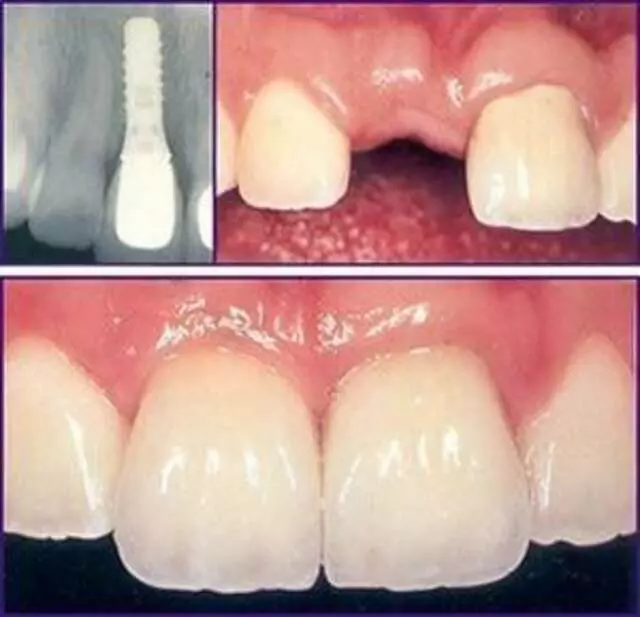 Advanced Smile Center