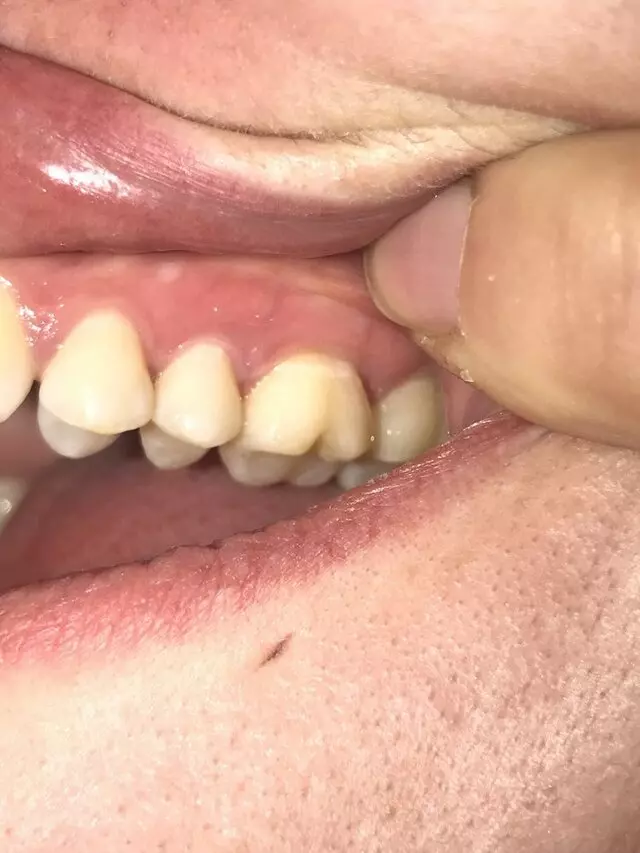 Advanced Smile Center