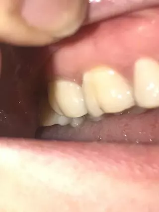 Advanced Smile Center