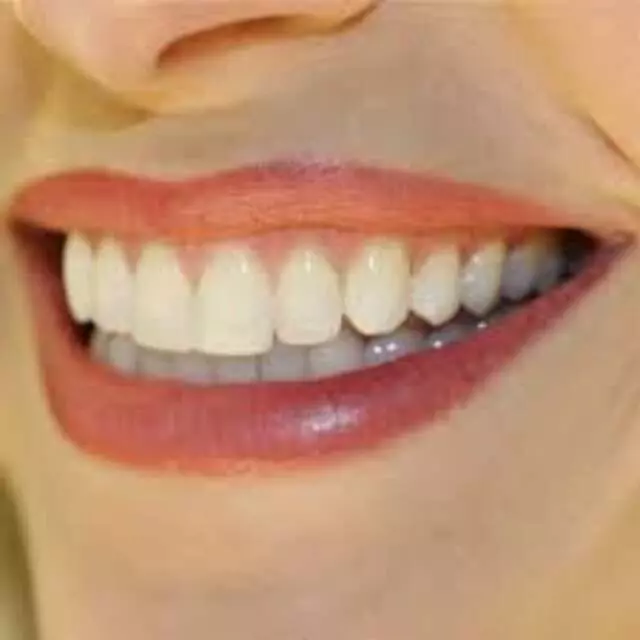 Advanced Smile Center