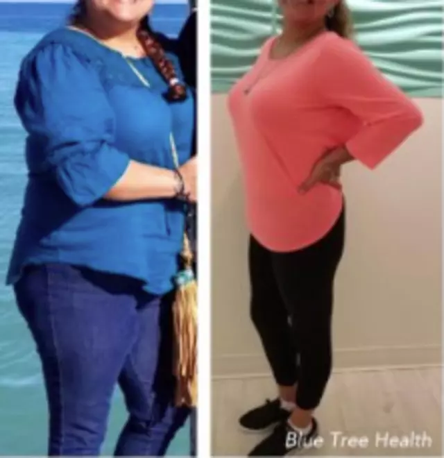 Blue Tree Health - Medical Weight Loss & Body contouring