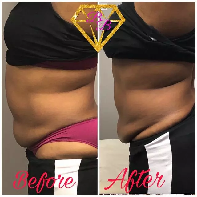 The BodyBar