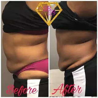 The BodyBar