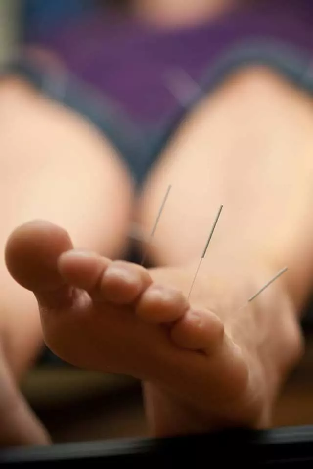 Acupuncture Together