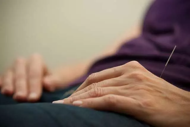 Acupuncture Together