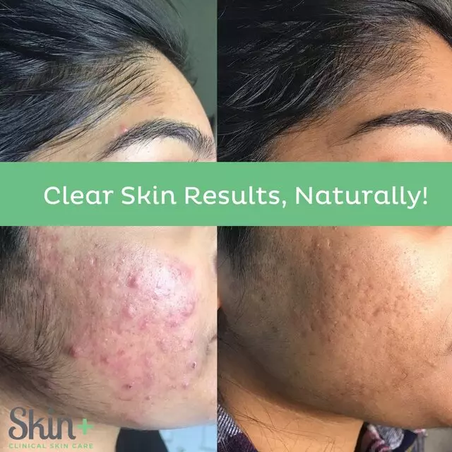 Austin Skin Plus