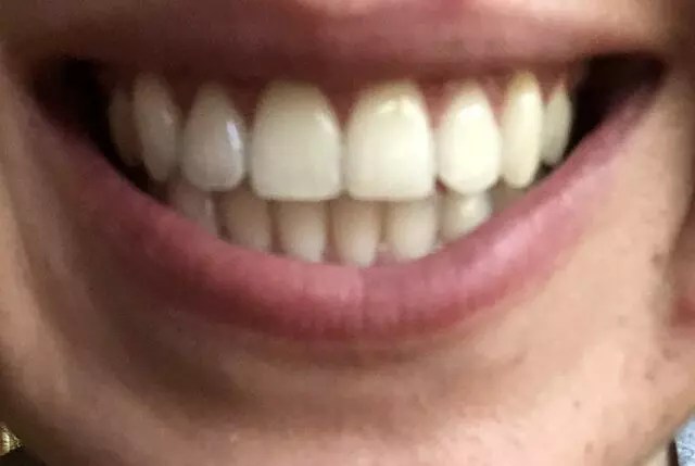 Austin Skyline Dental