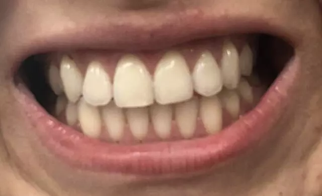Austin Skyline Dental